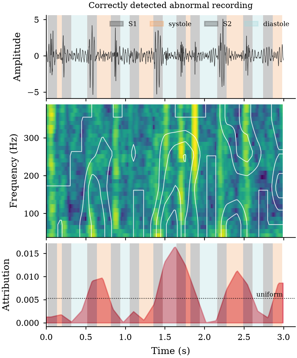 Main figure of What Does a Heart Sound Classifier Actually Learn? A Controlled Comparison of Cepstral, Spectral and Wavelet-Packet Representations with Cardiac-Cycle-Aligned Explanations
